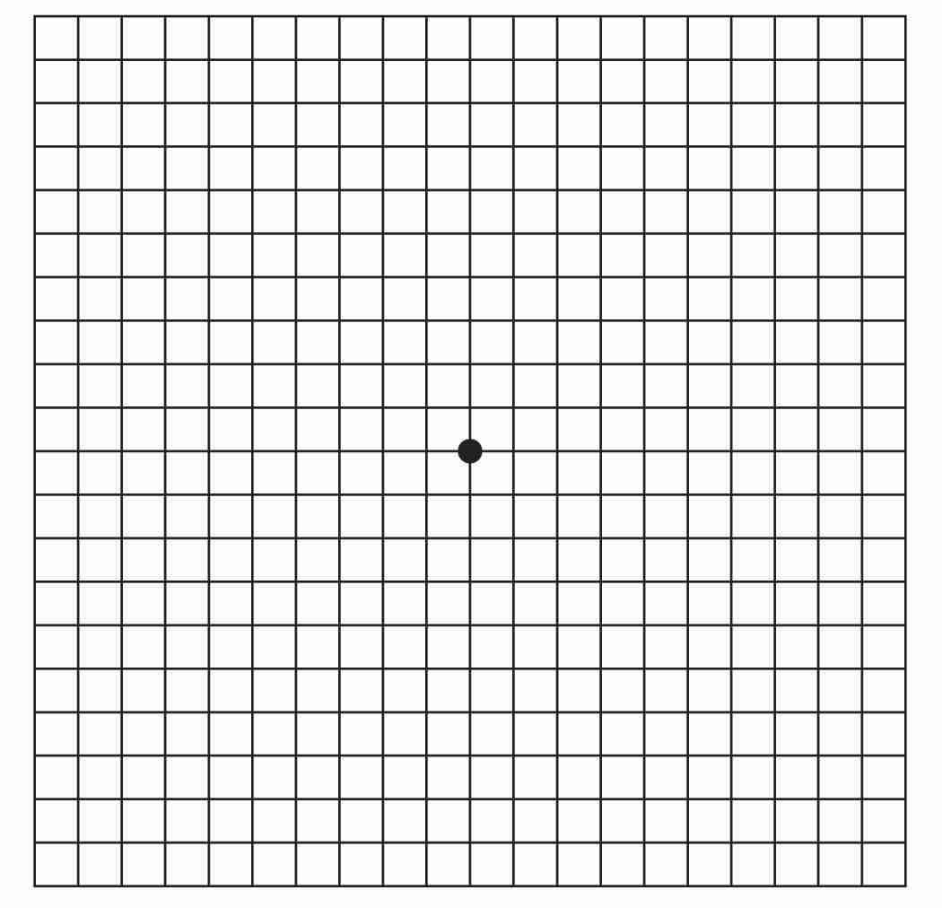 Amsler Grid er et værktøj til at teste sig selv for AMD. Behandling og operation tilbydes på Øjenhospitalet Danmark
