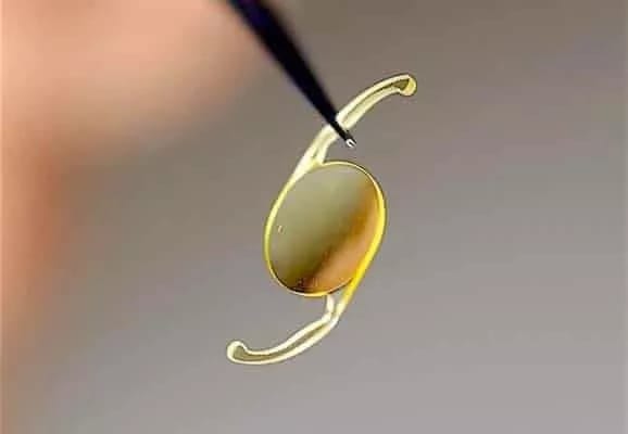 linseoperation til personer med øjenforkalkning