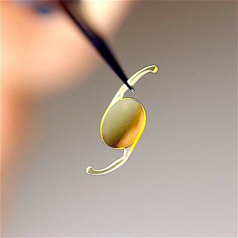 Gratis Grå Stær operation teknologi Øjenhospitalet Danmark.