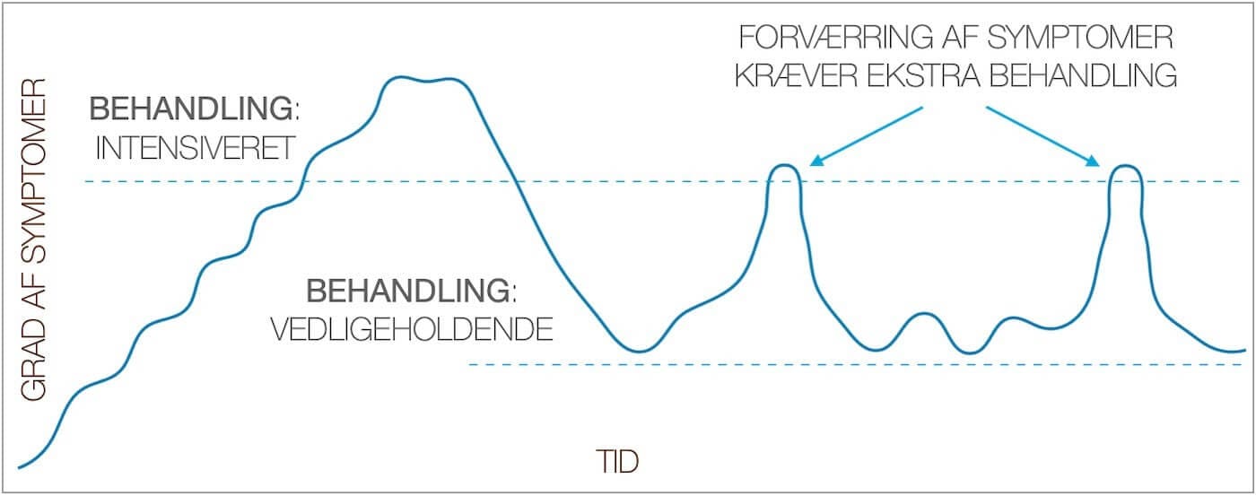 Billedet viser tørre øjne udvikling over tid.